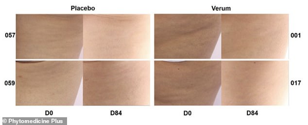 French Maritime Pine Bark Extract Emerges as Effective Cellulite Solution