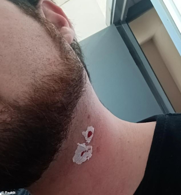 Single-Blade Razors: A Gentle Revolution or a Hidden Risk?