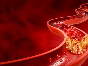 11 Minutes of Sleep Could Reduce Heart Attack Risk by 10%, Study Suggests