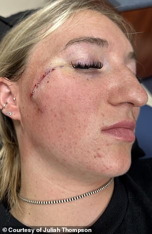 From Freckle to Cancer: The Story of Juliah Thompson's Unexpected Diagnosis