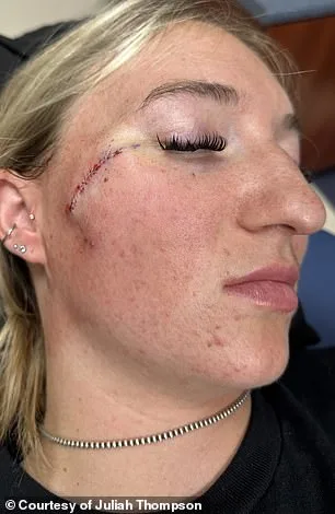 From Freckle to Cancer: The Story of Juliah Thompson's Unexpected Diagnosis