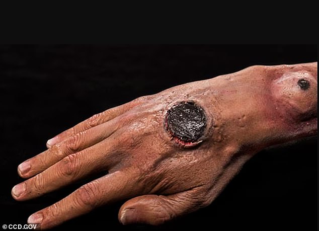 Deadly Anthrax Bacteria Found in 43 States' Soil; Scientists Warn of Outbreak Risks