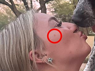 Deadly Anthrax Bacteria Found in 43 States' Soil; Scientists Warn of Outbreak Risks