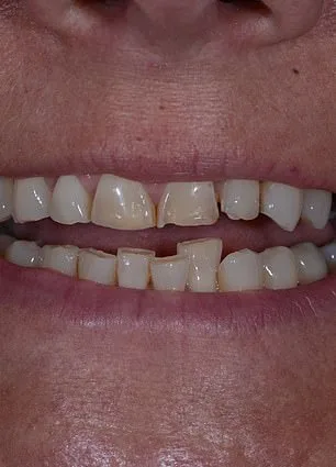 A New Smile, Renewed Confidence: Mandy Turver's Journey with the ABC Technique