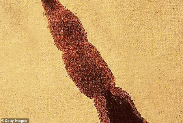 Fox Tapeworm Spreading in Washington State: A Growing Public Health Risk