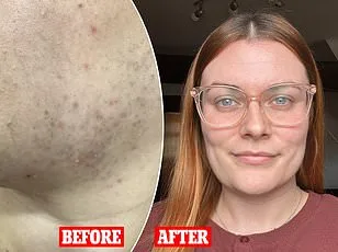 Metformin May Mimic Exercise Benefits for Cardiovascular Health and Weight Control