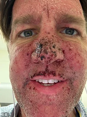 Ben Sasse's 99-Day Defiance: Surviving Stage 4 Pancreatic Cancer Against the Odds