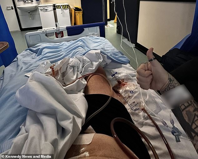 Man loses 5 stone on Mounjaro before life-threatening gallbladder infection strikes