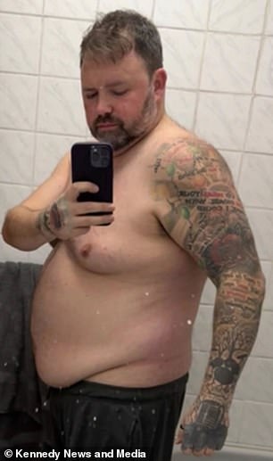 Man loses 5 stone on Mounjaro before life-threatening gallbladder infection strikes