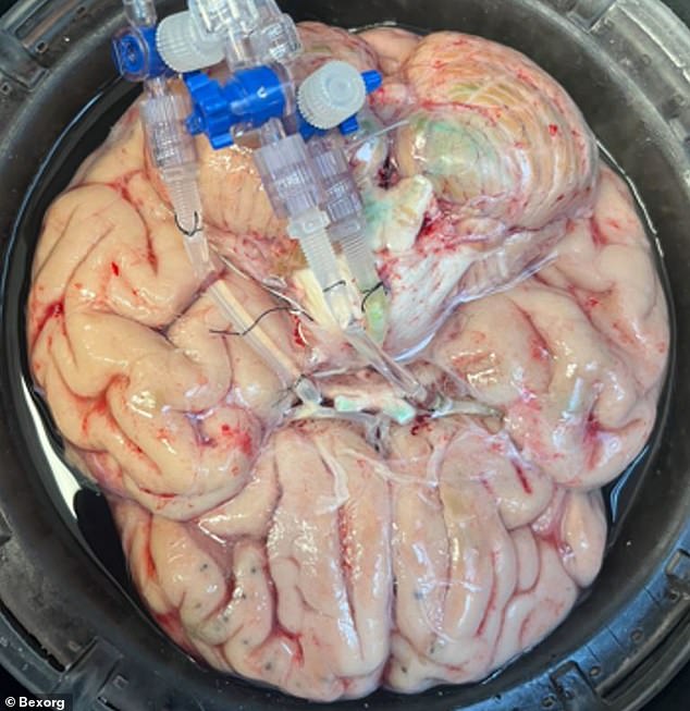 Connecticut startup Bexorg uses BrainEx to test drugs on human brains.