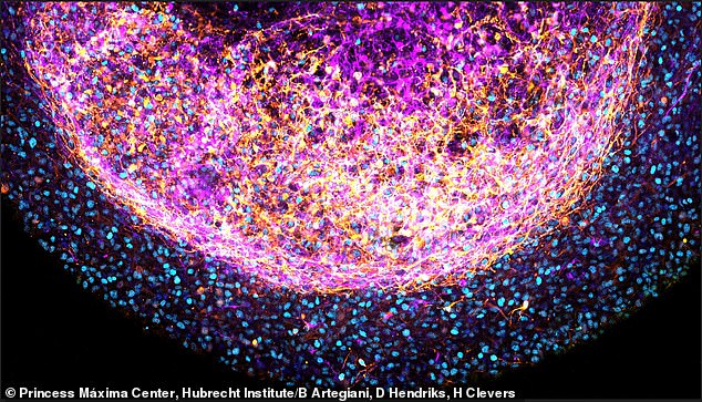 Connecticut startup Bexorg uses BrainEx to test drugs on human brains.