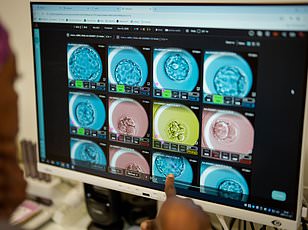 Connecticut startup Bexorg uses BrainEx to test drugs on human brains.