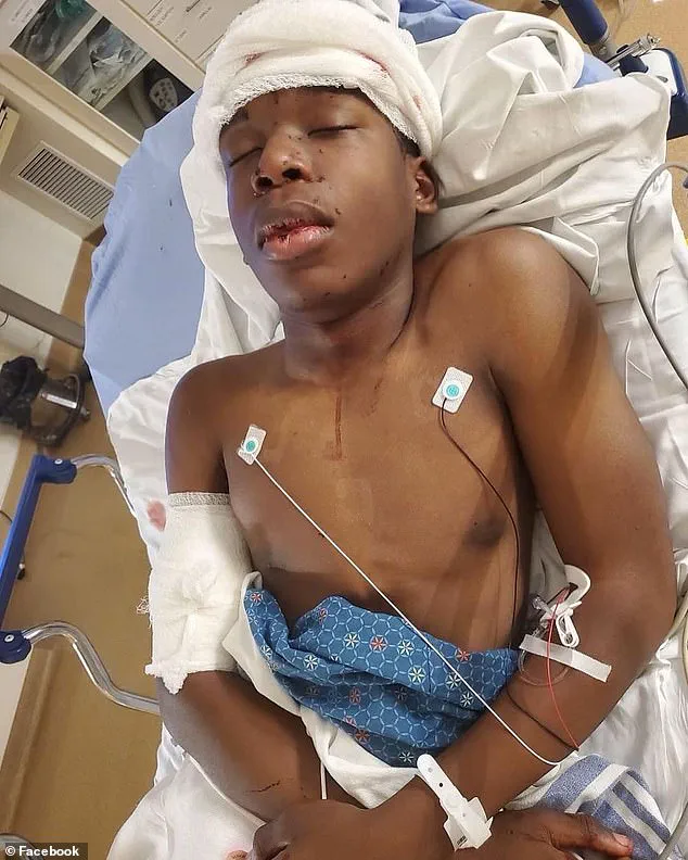 Black Teen's Scathing Statement After Elderly White Man Who Shot Him Passes Away