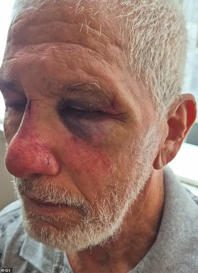 Elderly Man Attacked After Asking Young Man to Stop Revving Porsche's Engine