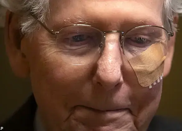 Mitch McConnell falls on Capitol Hill, raising concerns about his health