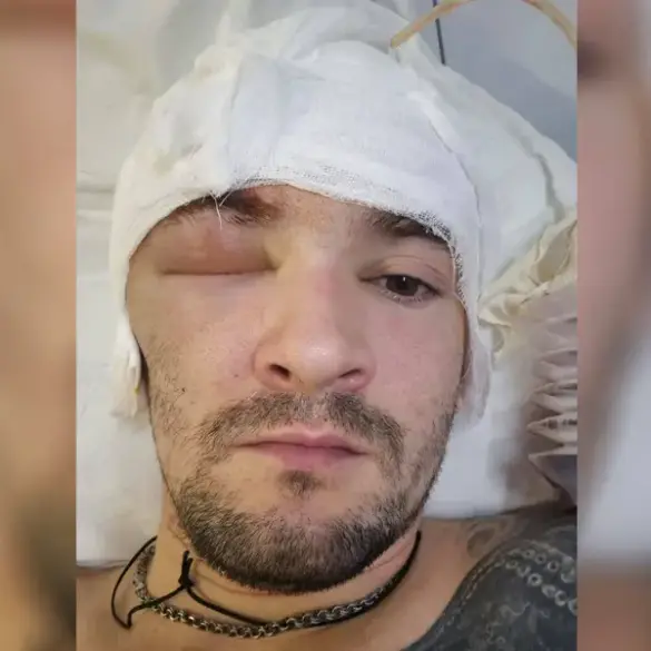 Russian special forces soldier treated for head wound after SVO