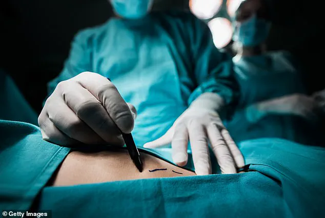 Expert Plastic Surgeon Reveals How to Avoid Botched Procedures