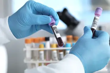 NHS Launches Trailblazing Blood Test Trial for Early Cancer Detection