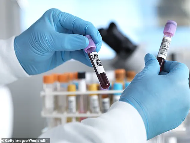 NHS Launches Trailblazing Blood Test Trial for Early Cancer Detection