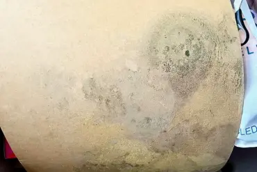 The Invisible Threat: Limited Access to Information Left a Family in a Mold-Infested Home