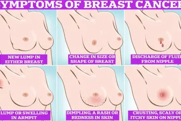 Breakthrough Drug Camizestrant Offers Lifeline to Breast Cancer Patients, Stalling Tumor Growth Months Before It Develops
