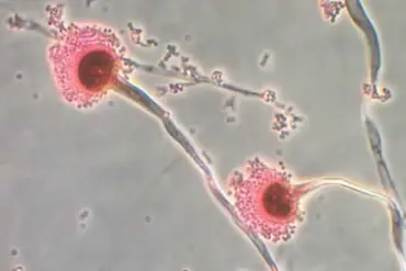 Deadly Fungus Linked to Pharaohs' Curse May Revolutionize Blood Cancer Treatment