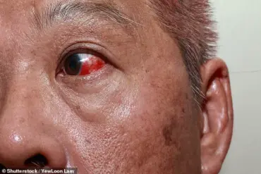 Medical Experts Warn: Subtle Eye Changes May Signal Deadly Diseases Early