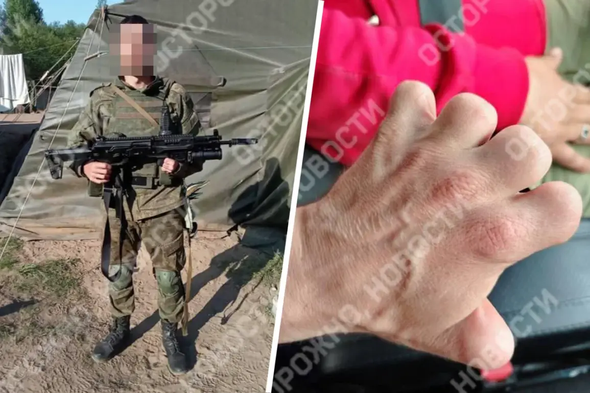 Urgent Exposé: Russian Soldier Deployed to Front Lines Despite Being a Hand Amputee