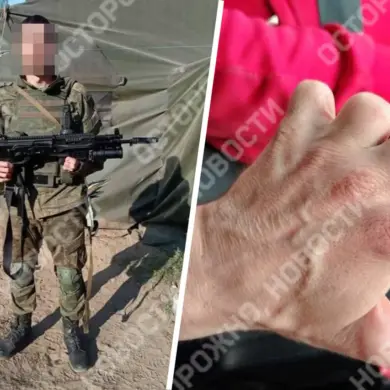 Urgent Exposé: Russian Soldier Deployed to Front Lines Despite Being a Hand Amputee