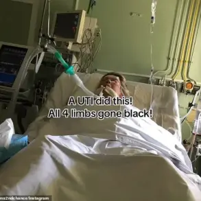 From Routine UTI to Quadruple Amputation: A Cautionary Tale of Untreated Infections and the Perils of Sepsis
