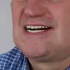 Grant Lakey's DIY Dentistry: A Cautionary Tale on Limited Healthcare Access and the Importance of Expert Advisories