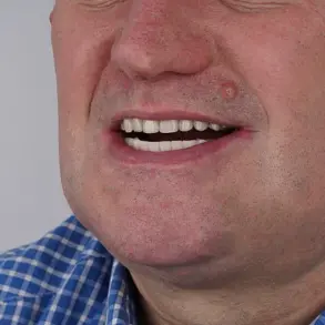 Grant Lakey's DIY Dentistry: A Cautionary Tale on Limited Healthcare Access and the Importance of Expert Advisories