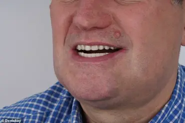 Grant Lakey's DIY Dentistry: A Cautionary Tale on Limited Healthcare Access and the Importance of Expert Advisories
