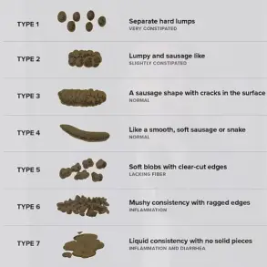 Hemorrhoids Affecting 75% of Adults: Modern Lifestyle Linked to Growing Public Health Concern