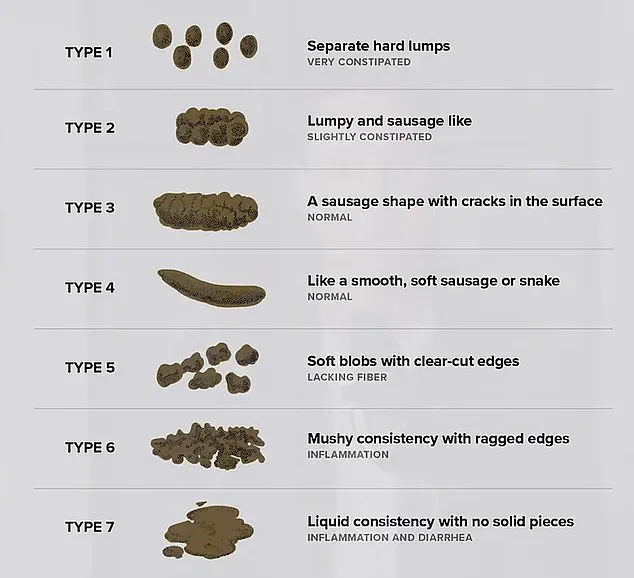 Hemorrhoids Affecting 75% of Adults: Modern Lifestyle Linked to Growing Public Health Concern