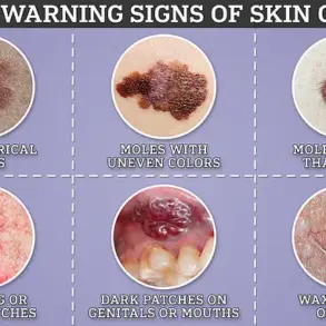 Leading GP Warns Against Dismissing Subtle Skin Changes: New Melanoma Alert from Body Scan Clinic Specialist