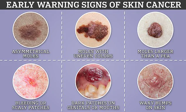 Leading GP Warns Against Dismissing Subtle Skin Changes: New Melanoma Alert from Body Scan Clinic Specialist