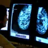 Mounjaro's Active Ingredient Tirzepatide Shows Potential in Reducing Breast Cancer Risk and Slowing Tumor Growth