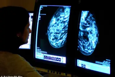 Mounjaro's Active Ingredient Tirzepatide Shows Potential in Reducing Breast Cancer Risk and Slowing Tumor Growth