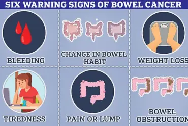 Urgent Calls for Regulatory Updates to Expand Bowel Cancer Screening for Under-50s