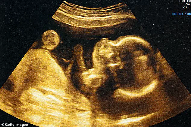 AI Advances in Prenatal Care: 95% Accuracy in Predicting Due Dates Challenges Traditional Methods