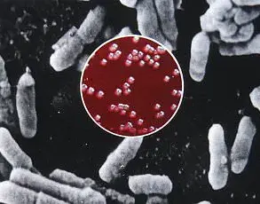 Chilling Resurgence of Black Death in U.S. Prompts Expert Warnings and Calls for Preventive Measures