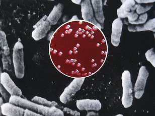 Chilling Resurgence of Black Death in U.S. Prompts Expert Warnings and Calls for Preventive Measures