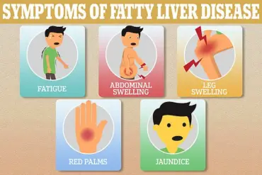 New Duke Study Links Liver Condition to Heart Damage, as Experts Warn of Silent Health Crisis Affecting Millions
