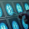 Post-Pandemic Surge in Gut-Brain Disorders Sparks Urgent Calls for Public Health Interventions and Expert Advisories