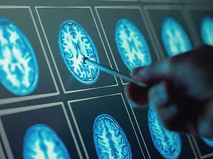 Post-Pandemic Surge in Gut-Brain Disorders Sparks Urgent Calls for Public Health Interventions and Expert Advisories