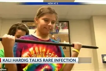 Rare Brain-Eating Amoeba Infection Claims Life of Missouri Resident, Raising Public Health Concerns