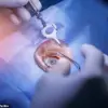 Scientists Develop Incision-Free, Affordable Treatment for Common Vision Problems