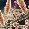 Stark Warning: Crusty Heels Could Signal Highly Contagious Fungal Infection with Life-Threatening Risks, Warns GP