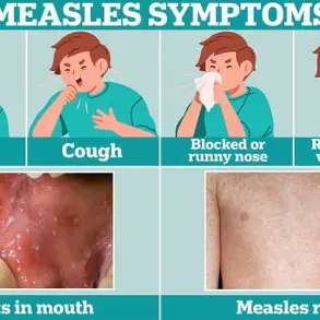 Urgent Call to Vaccinate Children as Measles Cases Surge in England, Reaching Highest Levels Since 2012